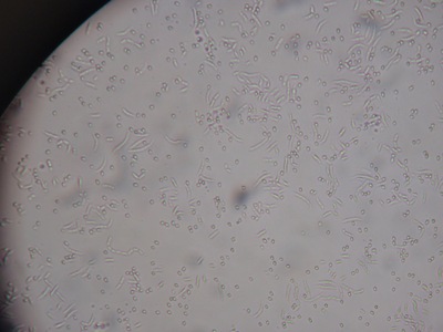 bacteria2.JPG